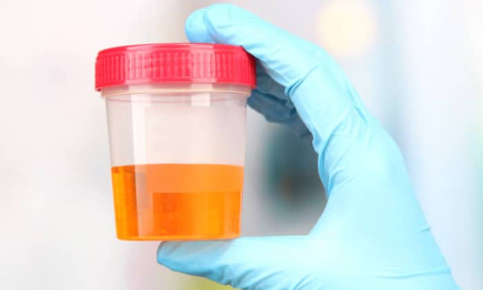 drug-test-urine