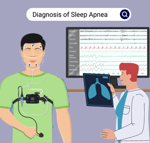 Diagnosis-of-Sleep-Apnea