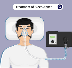 Treatment-of-Sleep-Apnea