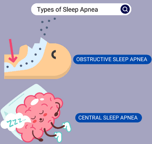 Types-of-Sleep-Apnea